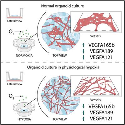 Enhanced Microvasculature Formation and Patterning in iPSC–Derived Kidney Organoids Cultured in Physiological Hypoxia